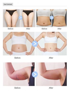 E-GO SLIM - ĐIÊU KHẮC CƠ THỂ